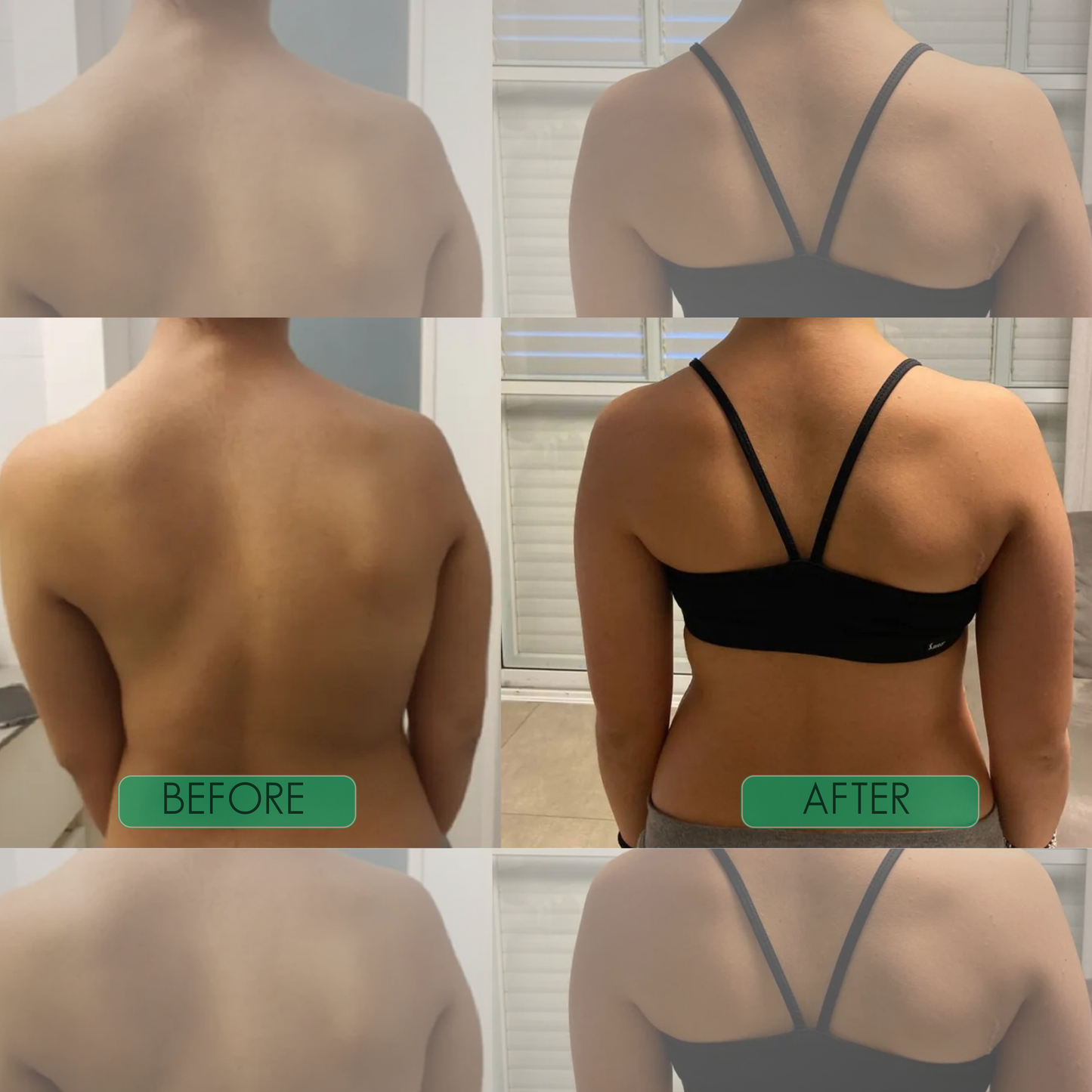 Instant Posture Corrector - 3