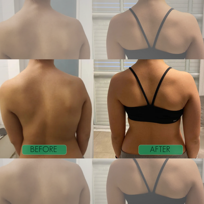 Instant Posture Corrector - 3