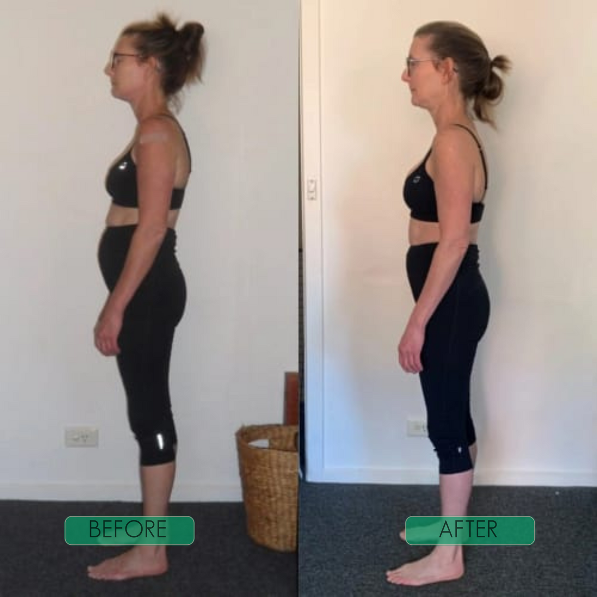 Instant Posture Corrector - 6